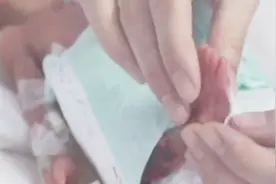 孕妇怀有罕见的五胞胎，早产夭折一个其余四个孩子情况也不容乐观视频封面