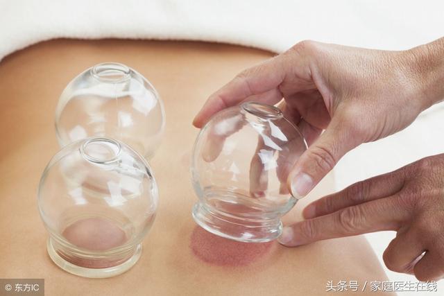 拔完火罐抹身体乳吗