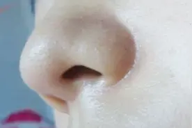 洗完脸先拍水再擦乳？难怪皮肤粗糙干燥死难看，教你一招白嫩紧致视频封面