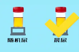 下午可以做尿常规检查吗？检查结果会受影响吗？视频封面