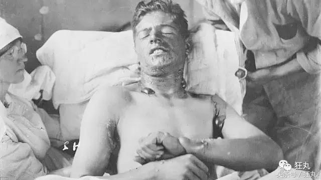 吃鸡皮肤毒性 吃鸡皮肤毒性