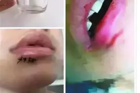 称宜家水杯爆炸致毁容，女子索赔百万 宜家：不能证明是我商品图片