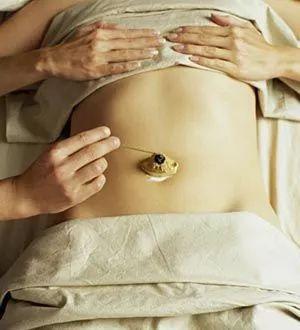 花胶和姜贴肚脐 花胶和姜贴肚脐的作用