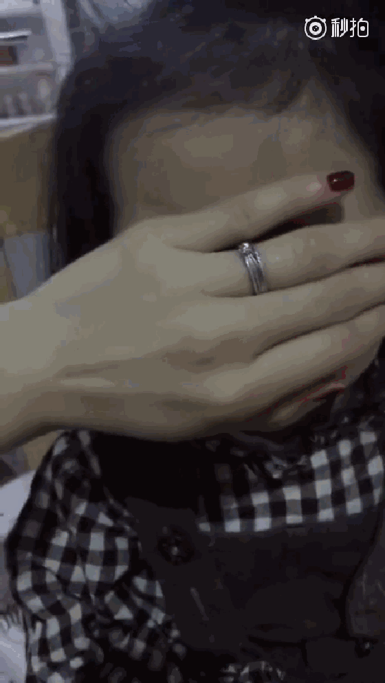 蒙古褶是啥？宝宝长了蒙古褶眼睛就会不好看吗？妈妈快来看看吧