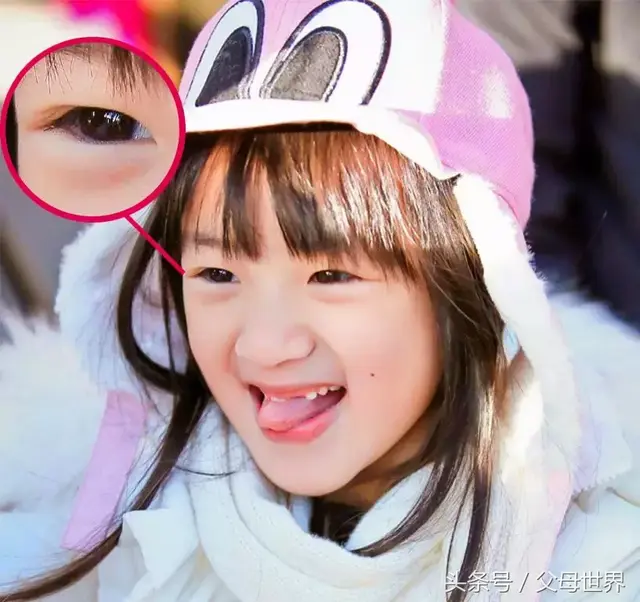 蒙古褶是啥？宝宝长了蒙古褶眼睛就会不好看吗？妈妈快来看看吧