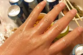 被烫伤不要慌，用这个小偏方，简单快速去痛还不留伤疤！视频封面