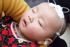 宝宝输液为什么针要扎在头上？对大脑有影响？家长快看看！视频封面