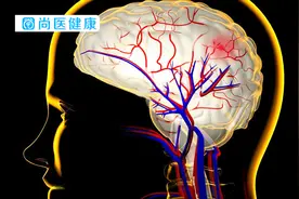 脑血管供血不足的注意事项，生活中做好这几点，才能让家人安心！视频封面