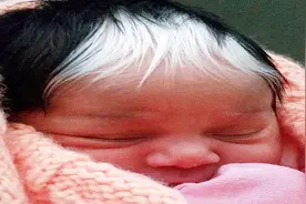 刚出生婴儿额头生白发，现在医护人员惊讶！看一眼妈妈后医生笑了视频封面