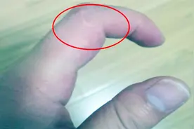 为什么许多男人手指，都会有一道伤疤？答案你绝对想不到