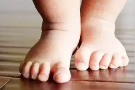 宝宝最爱光脚，宝妈要知道光脚的好处与坏处视频封面