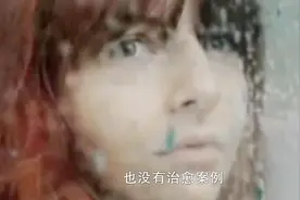 世界上有人对水过敏？那他们是怎么坚持不洗澡不喝水活到80岁的？