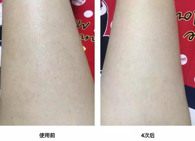 去鸡皮肤的磨砂膏和身体乳 去鸡皮肤的磨砂膏和身体乳