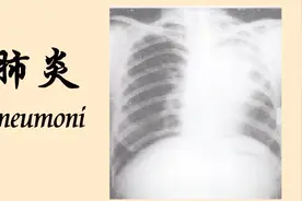 肺炎会不会传染呢？你可能不了解它视频封面