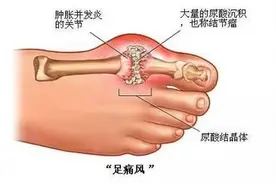 「健康」全了！各年龄段血压、血糖、血脂、尿酸对照表，快告诉家人图片