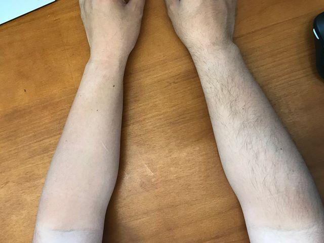 椋庨潯鏃ユ湰鐨勮劚姣涜啅锛屽揩閫熸妸姣涜劚鎺夛紝鏂伴暱鍑烘潵涔熶笉浼氬彉纭紵