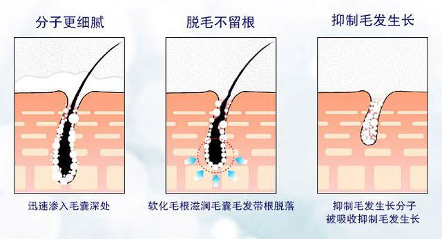 椋庨潯鏃ユ湰鐨勮劚姣涜啅锛屽揩閫熸妸姣涜劚鎺夛紝鏂伴暱鍑烘潵涔熶笉浼氬彉纭紵