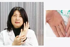 医生提醒，手掌出现这种表现，可能代表肝功能出现问题了视频封面