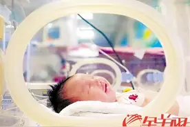21天新生儿肠梗阻转危为安 创佛山此类手术最小患者纪录图片