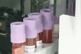 为什么人血是红色的？医生为你详细分析