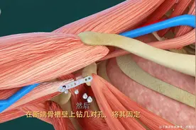 3D演示：肱二头肌肌腱断裂，咋一看不明白，原来是这么回事！视频封面