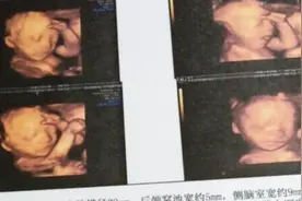 孕妈看这里：做四维彩超的时候，医生有这样说吗？聪明孕妈知男女视频封面