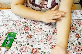 夏天炎热，容易长痱子，别急着花钱，可以这样用牙膏试试