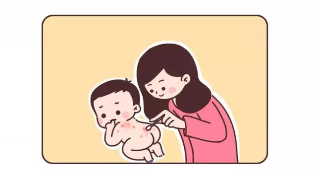 治痱子就靠这个