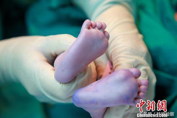 世界首例“线粒体移植婴儿”在广州出院，破解原发性不孕难题