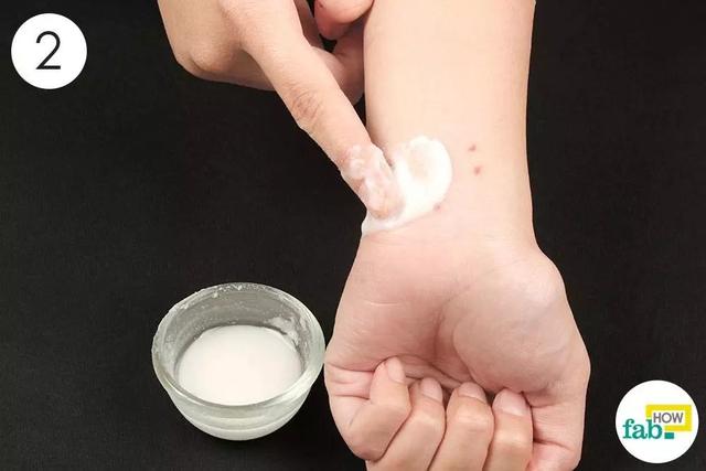 总被蚊子咬？！涂点这个马上止痒，还不花一分钱