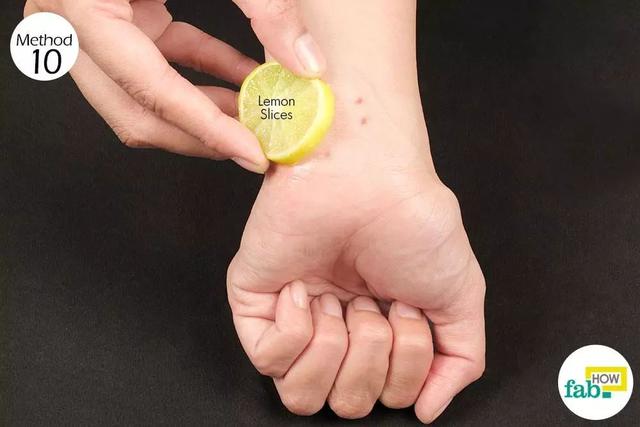 总被蚊子咬？！涂点这个马上止痒，还不花一分钱