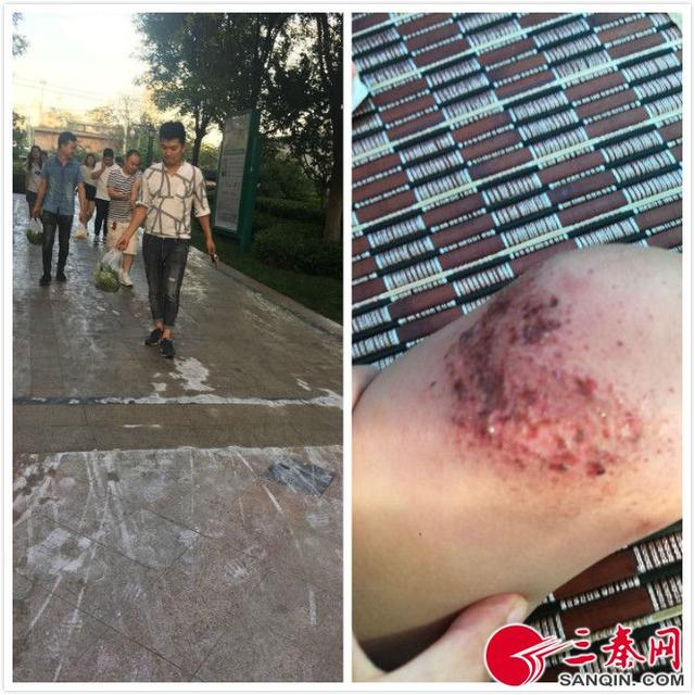 氢氧化钠与水反应（小区用烧碱水清洗路面 3名幼童摔倒后被灼伤）