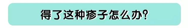宝宝身上的红疹子不能掉以轻心!担心丘疹性荨麻疹找上门