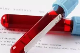 「交通事故」血样送检程序违法，醉驾案件存疑不诉或宣告无罪（附判决书两份、不起诉书两份）图片