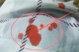 棉被上染上血渍很难清洗？教你四招，轻松祛除无痕迹视频封面