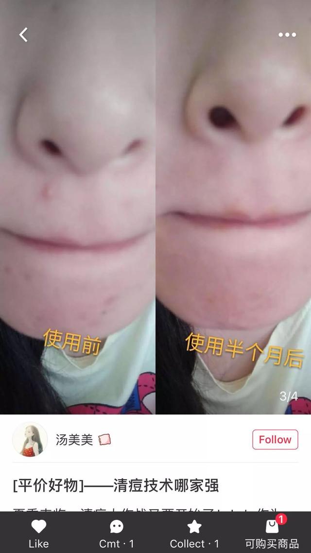 尖货｜稳定肌肤的小秘密，夏天和喷雾最配