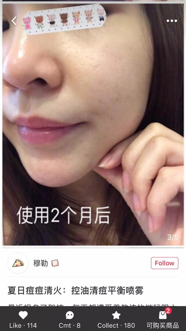 尖货｜稳定肌肤的小秘密，夏天和喷雾最配