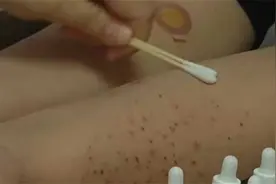 夏天格外注意！女子养猫数月全身长癣 宠物的皮肤病也会传染给人视频封面