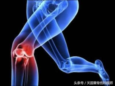 医案分享：不是所有的关节炎都能用氨基葡萄糖胶囊！