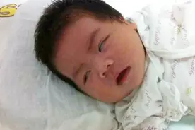 宝宝睡着了却在翻白眼，如果医生不说，你绝对不知道的啥原因视频封面