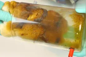 吸完300根香烟后，你的肺部可能会像这团棉花一样，你还敢吸烟吗