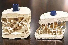 营养师：曝光3种不靠谱的补钙食品，看完要记住图片