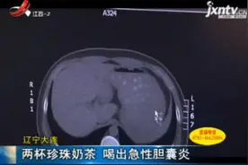 辽宁大连：两杯珍珠奶茶 喝出急性胆囊炎视频封面
