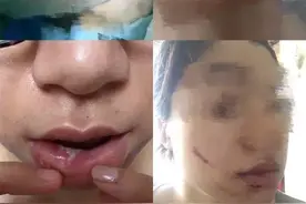 水杯爆裂当场昏迷，一颗门牙索赔105万，法院为何只判宜家赔4万？图片