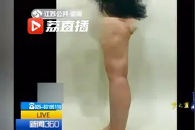 女子吸脂瘦腿致凹腿塌臀 修复费超10万元视频封面