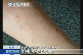 胆大！为除螨大爷全身涂满敌敌畏专家告诉你如何有效除螨？视频封面