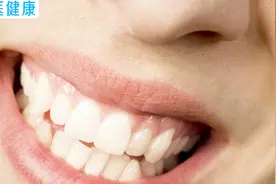 洗牙为什么会牙缝变大，你还敢不安的洗牙吗？这些科普你应该知道视频封面
