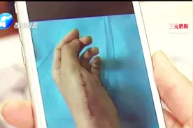 拿新买的陶瓷刀削个梨，郑州女孩血流不止，缝20针，这刀居然……视频封面