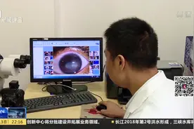 14岁初中女生网购劣质隐形眼镜 竟感染了寄生虫 左眼险些失明视频封面
