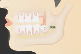拔了智齿很痛怎么办？医生说的这几种缓解方法要知道